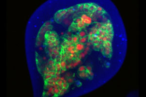 app-confocale-spinning-disk